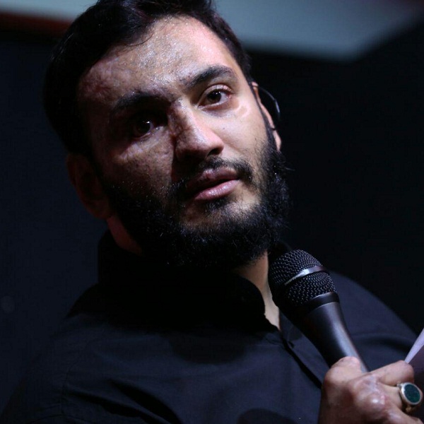 مداحی حبیب عبدالهی افتاده سرت افتاده تنت وای دق میکنه از غم مادرت